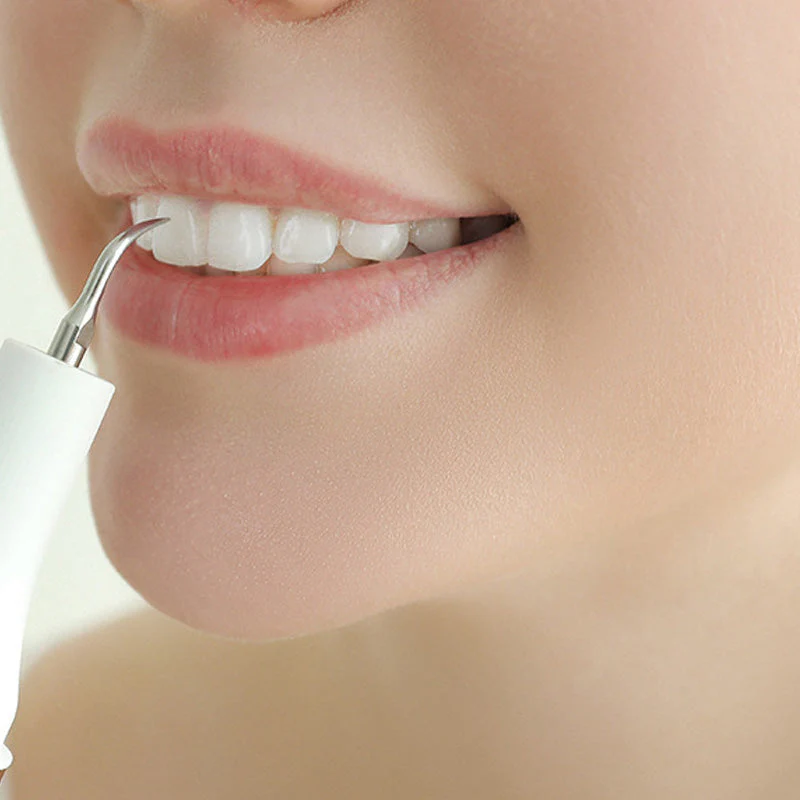 DentalCare – Instantly Removes Stubborn Plaque for a Radiant Smile - Image 2