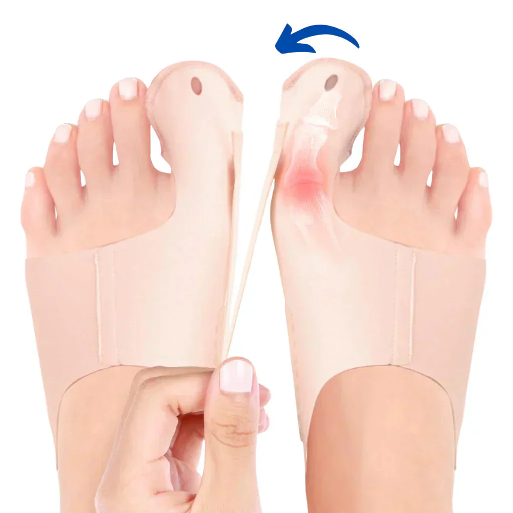 OrthoFlex – Pain-Free Steps for Hallux Valgus! - Image 8