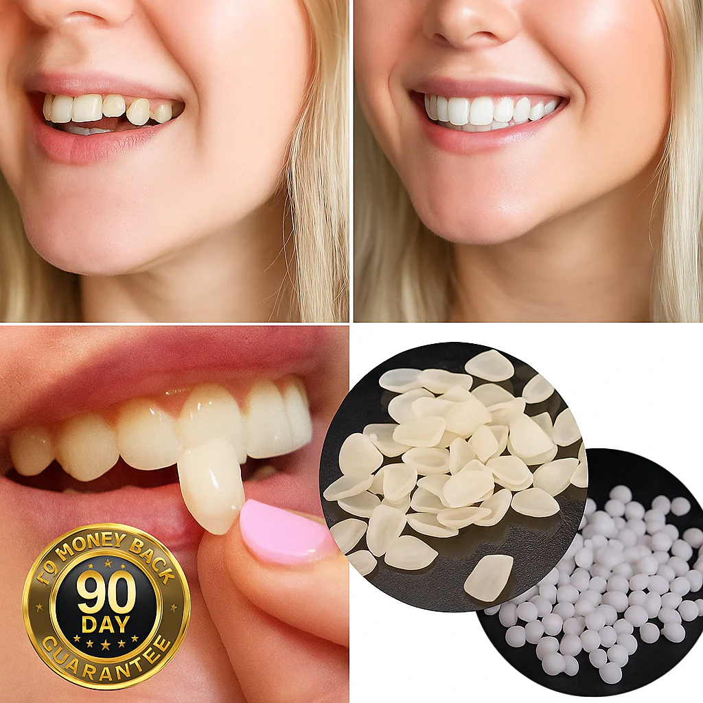 SmileFixer – Instant Restoration of Perfect, Naturally Looking Teeth at Home